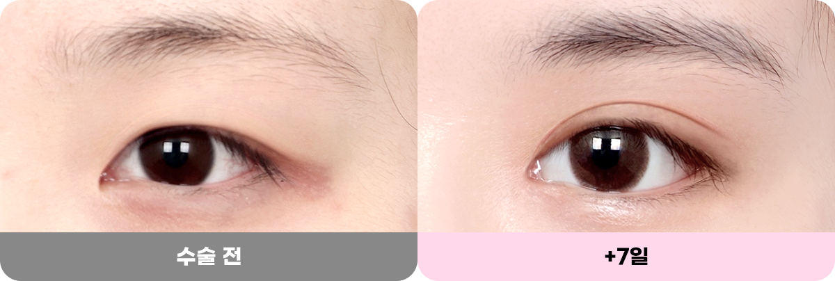 디에이 화려한 세미아웃