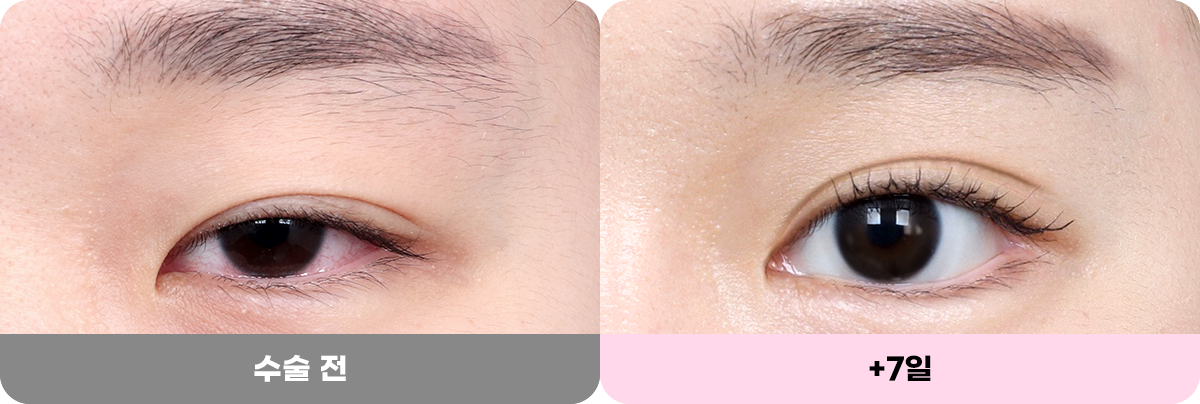 디에이 화려한 세미아웃