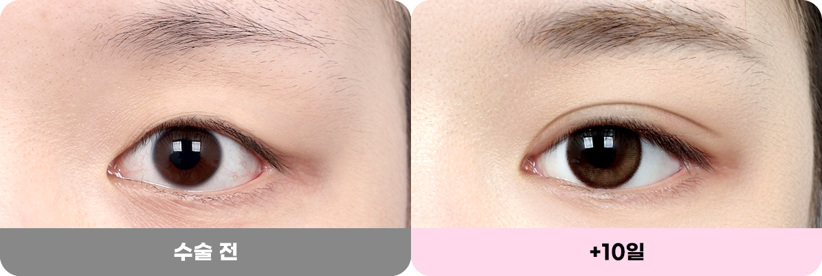 디에이 화려한 세미아웃