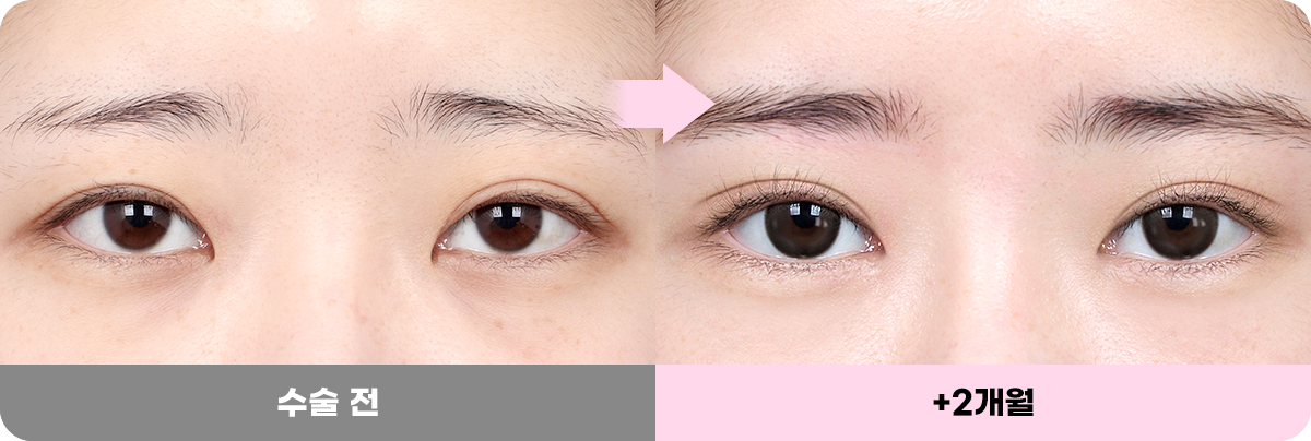 디에이 화려한 세미아웃