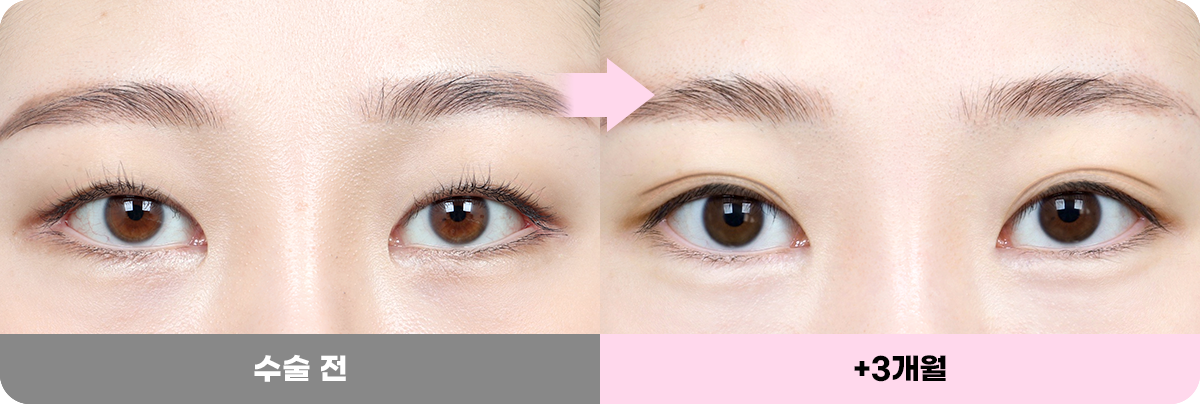 디에이 화려한 세미아웃