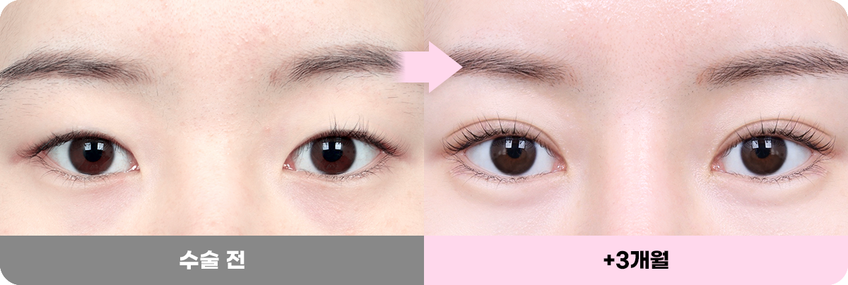 디에이 화려한 세미아웃