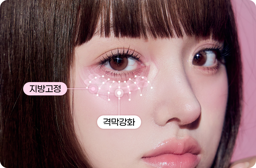 디에이 눈밑 지방재배치