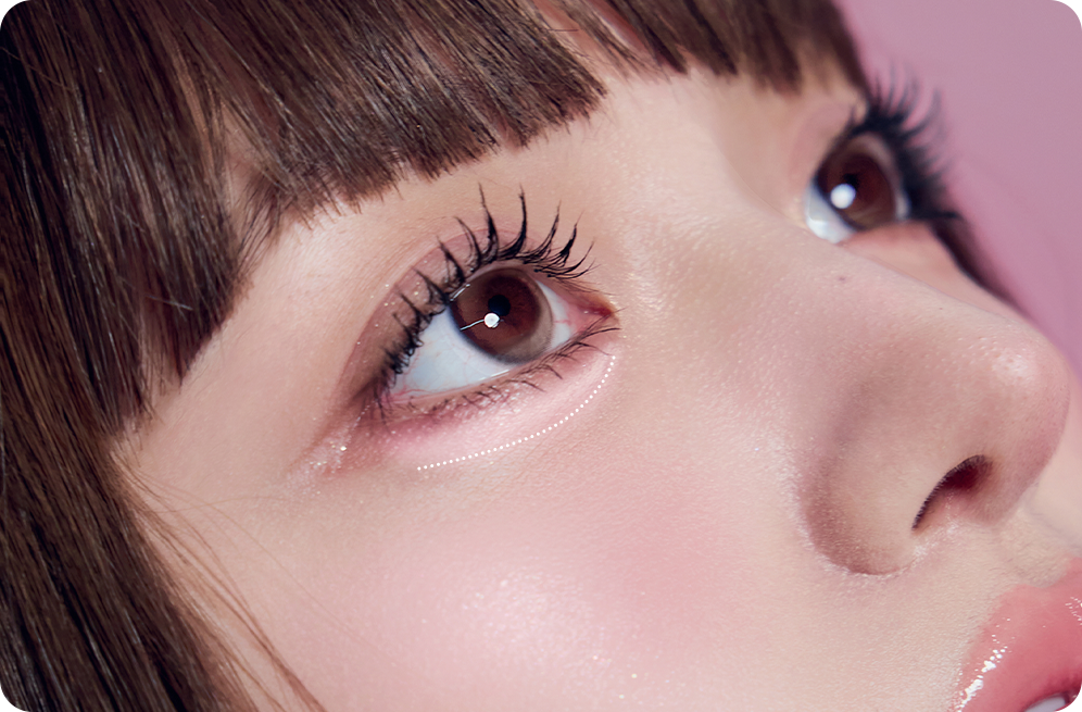 디에이 눈밑 지방재배치