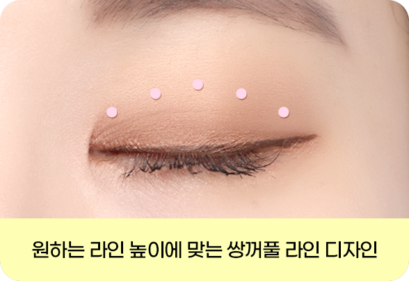 디에이 눈매 교정