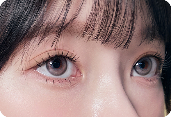 디에이 눈매 교정