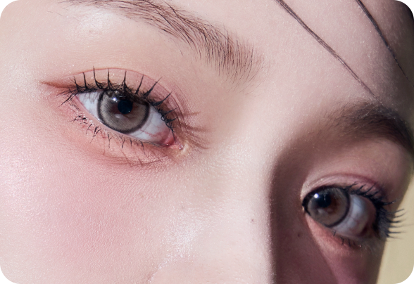 디에이 눈매확장트임