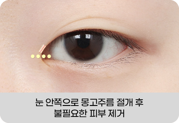 디에이 몽고트임