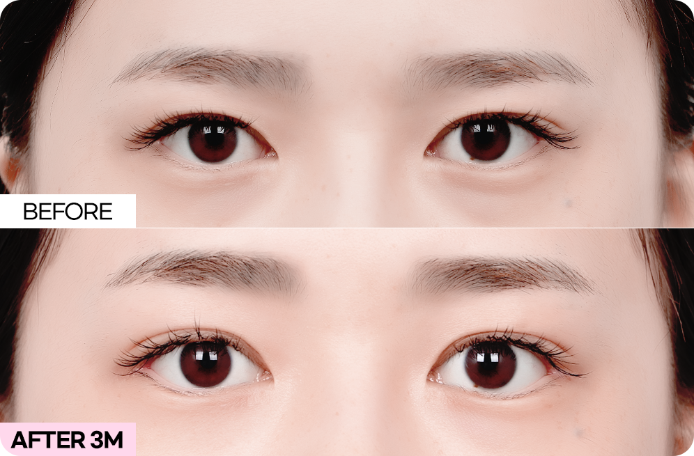 디에이 브로우업