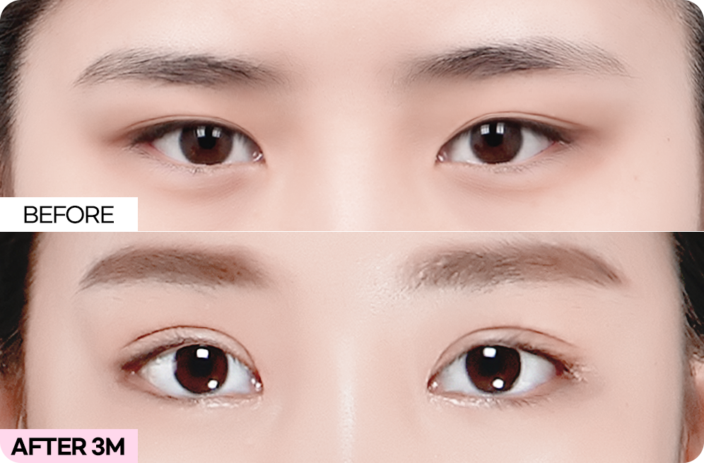 디에이 브로우업