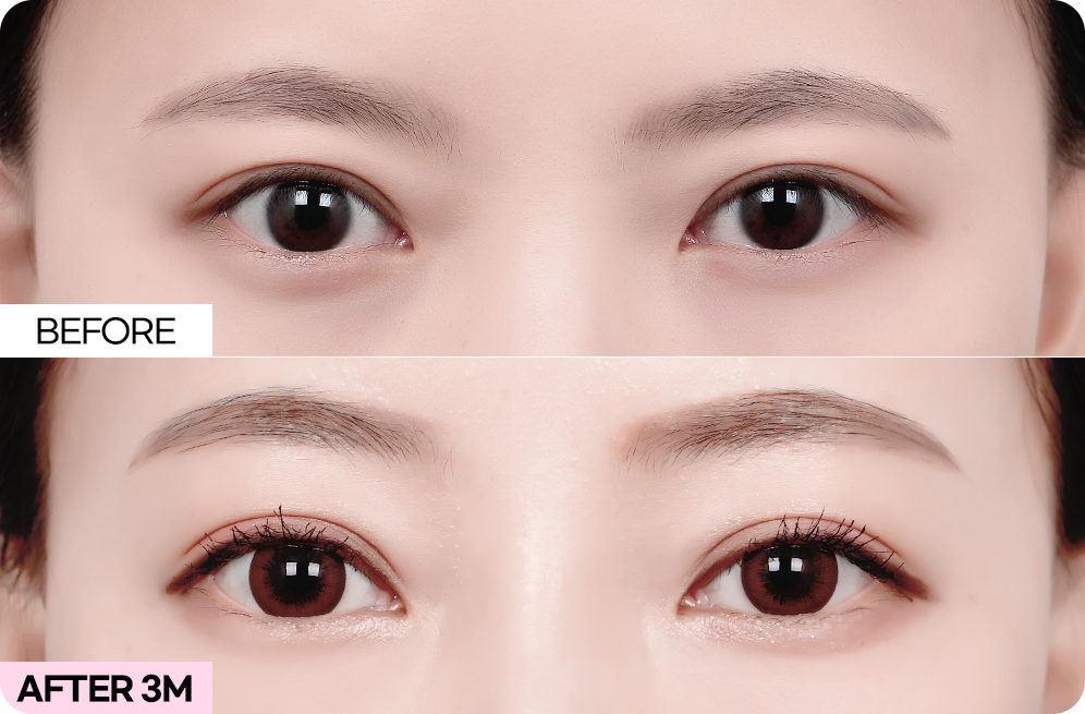 디에이 브로우업