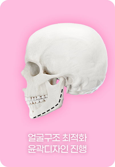 디에이 노핀윤곽