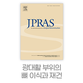 디에이 노핀윤곽