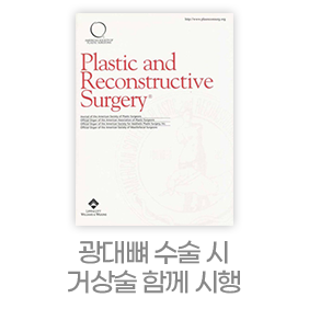 디에이 노핀윤곽