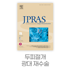 디에이 노핀윤곽