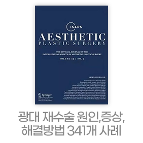 디에이 노핀윤곽