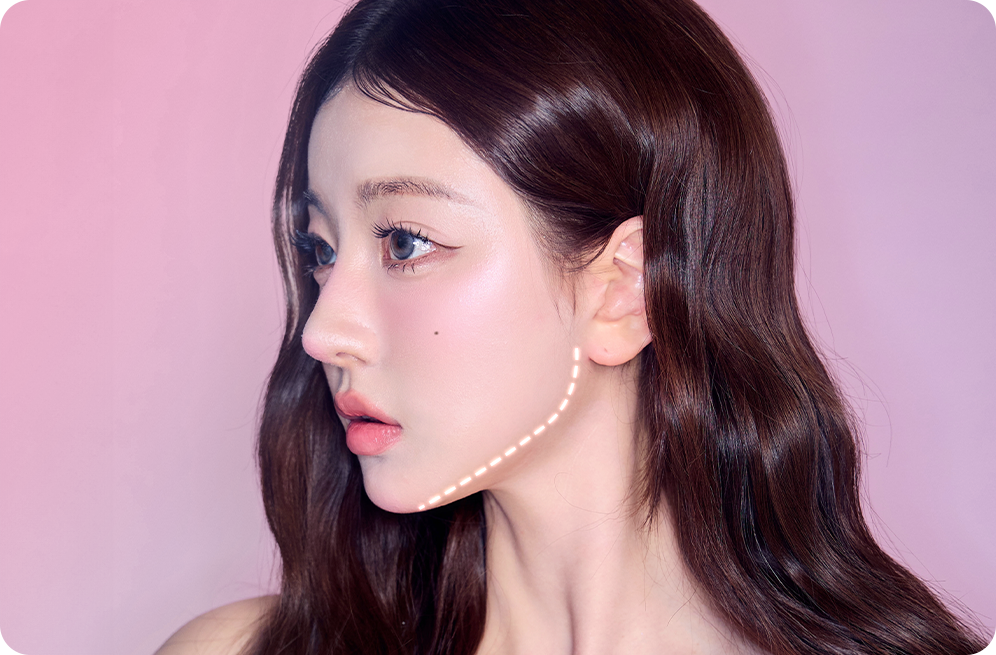 디에이 노핀윤곽