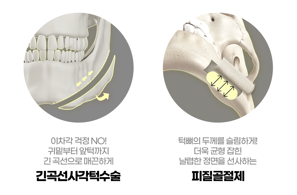 디에이 윤곽2종