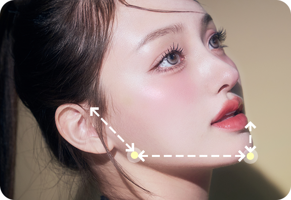 디에이 사각턱수술