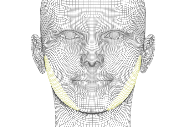 디에이 사각턱수술