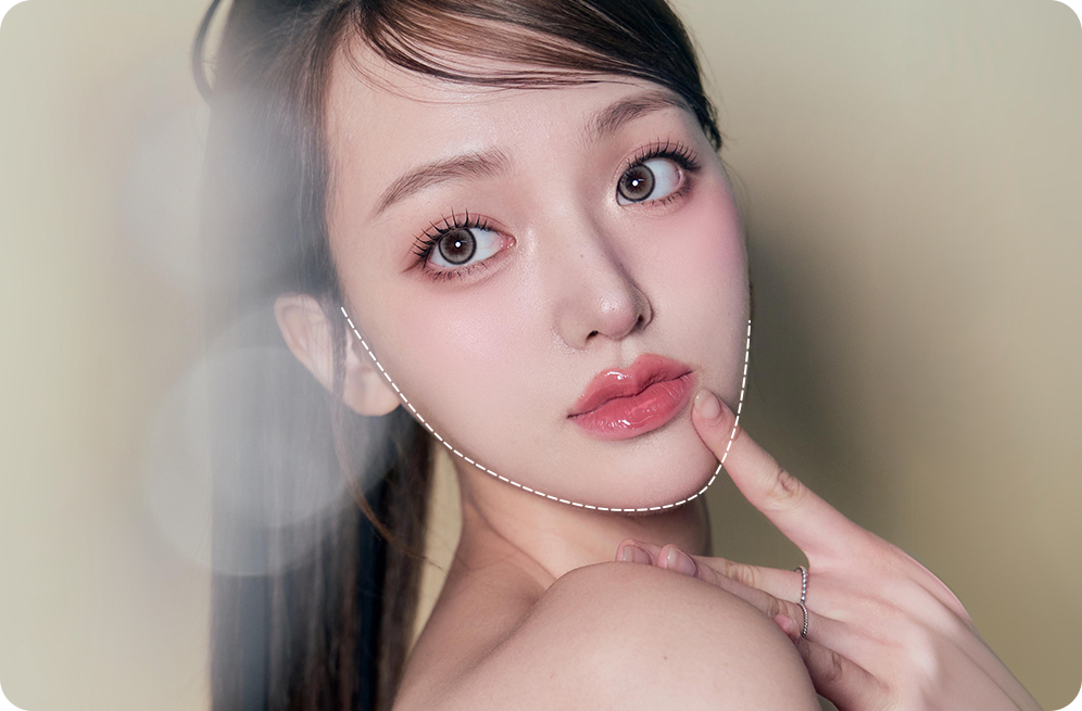 디에이 사각턱수술