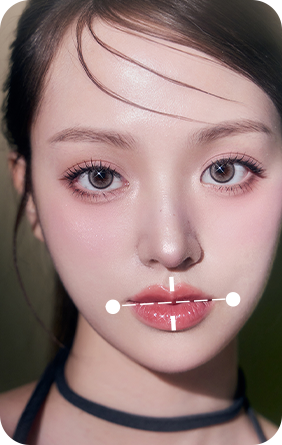 작은 턱 안면윤곽 재수술