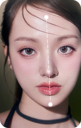 치아 교합 안면윤곽 재수술