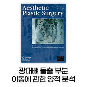 광대뼈 돌출 부분 이동에 관한 양적분석