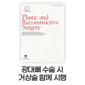 광대뼈 수술시 거상술 함께 시행
