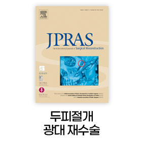 두피절개 광대재수술