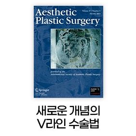 새로운 개념의 V라인 수술법