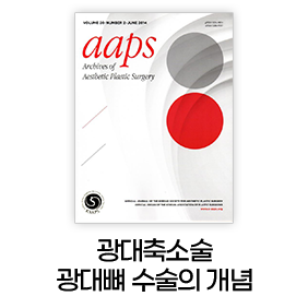 광대축소술 광대뼈 수술의 개념