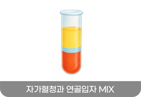 자가혈청과 연골입자 MIX