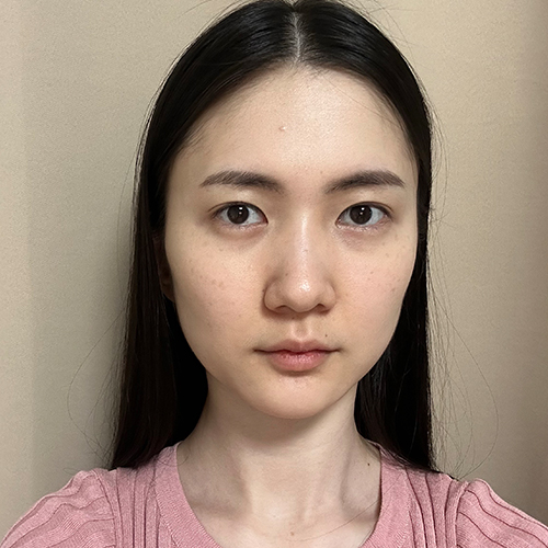 수술 전 (2)_500.jpg