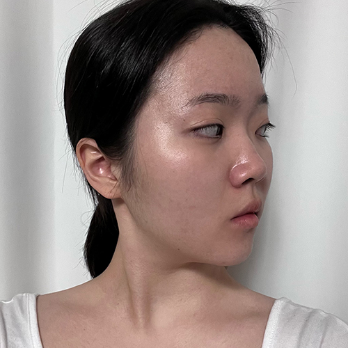 수술 전 (1)_500.jpg