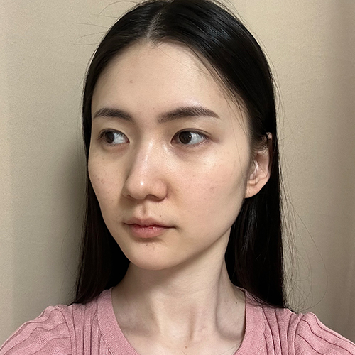 수술 전 (1)_500.jpg