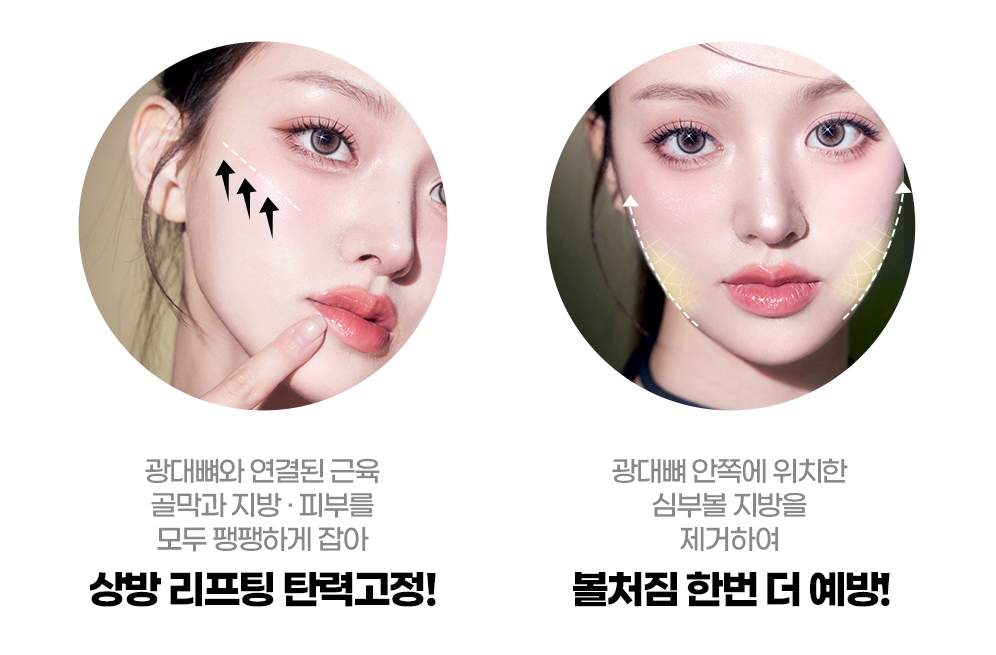 안면윤곽수술 효과2